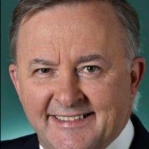 Anthony Albanese